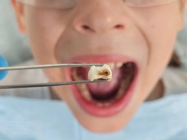 Urgent Tooth Repair in NE